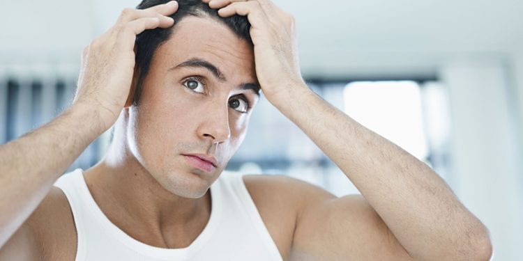 ปัญหาเส้นผมของหนุ่มๆ 3 สไตล์