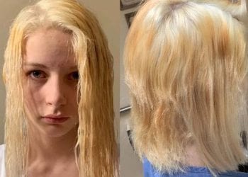 ผมพัง!! สาวซื้อน้ำยามากัดสีมาทำผมเอง แต่ทำพลาดผมร่วงเป็นกระจุก