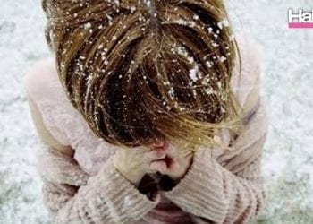 ปัญหาผมที่มาพร้อมกับลมหนาว