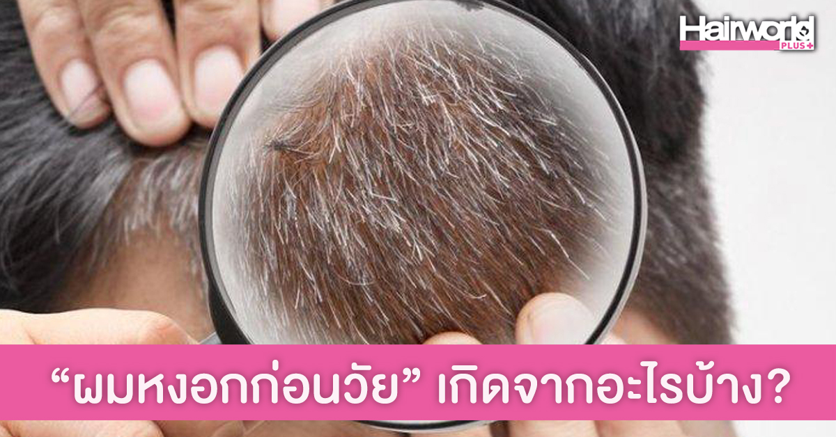 เปิด 5 สาเหตุสำคัญ ที่ทำให้ผมหงอกก่อนวัยอันควร