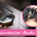 กรมการแพทย์เตือน! ย้อมผมหงอกบ่อยๆ อันตราย ส่งผลเสีย ตับพัง ไตเสื่อม